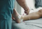 Beda Izin Praktik Mandiri Fisioterapi dengan Izin Klinik